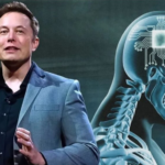 Mente Hacker? Elon Musk implanta chip cerebral sem fio em humano – Mas será que é tudo o que dizem?